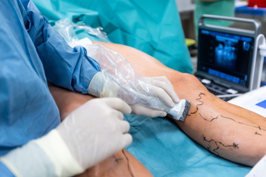 Vascular Surgery Services in Secunderabad