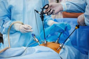 Best Laparoscopic Surgeon in Secunderabad