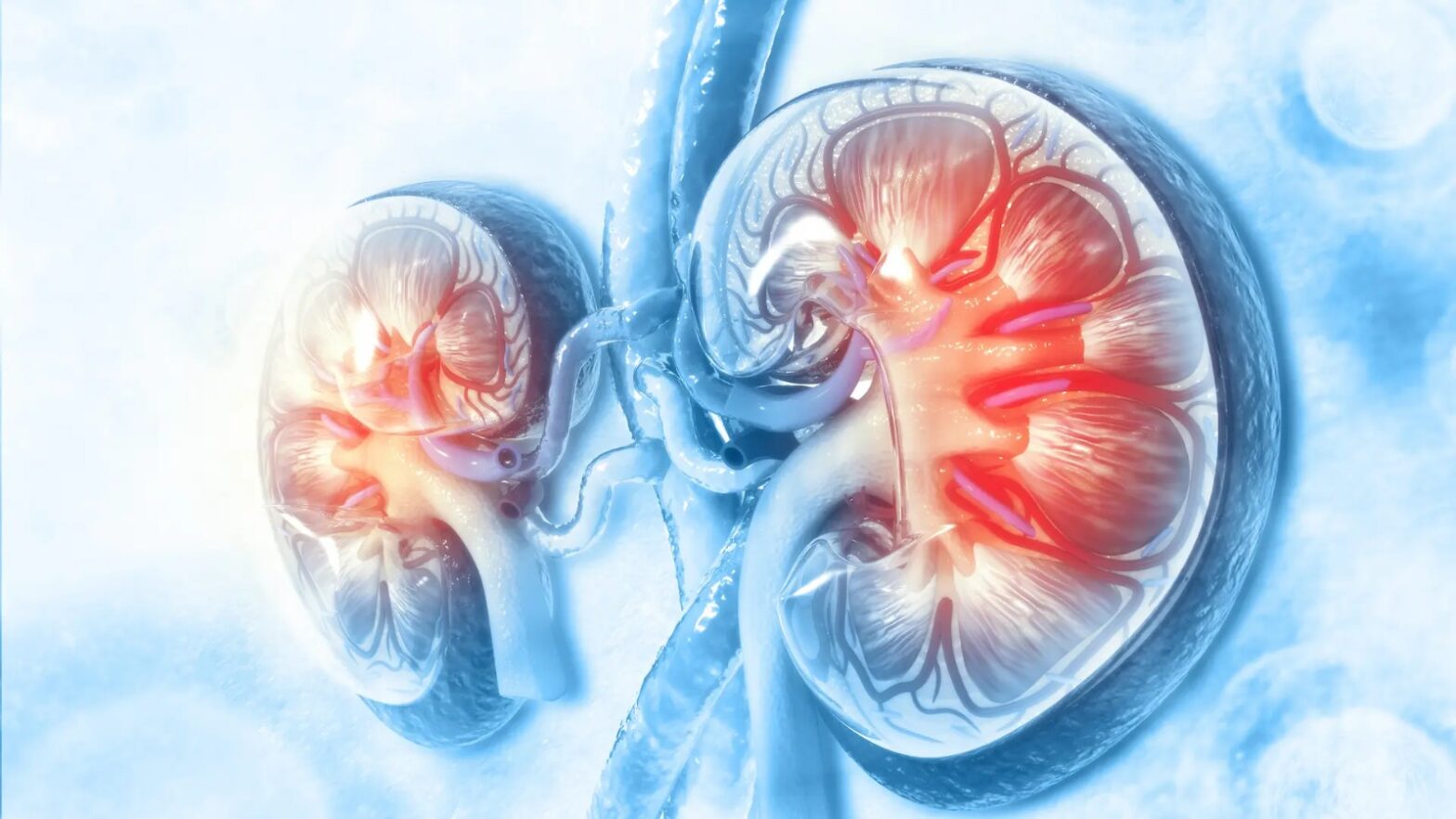 Best Kidney Specialist in Secunderabad